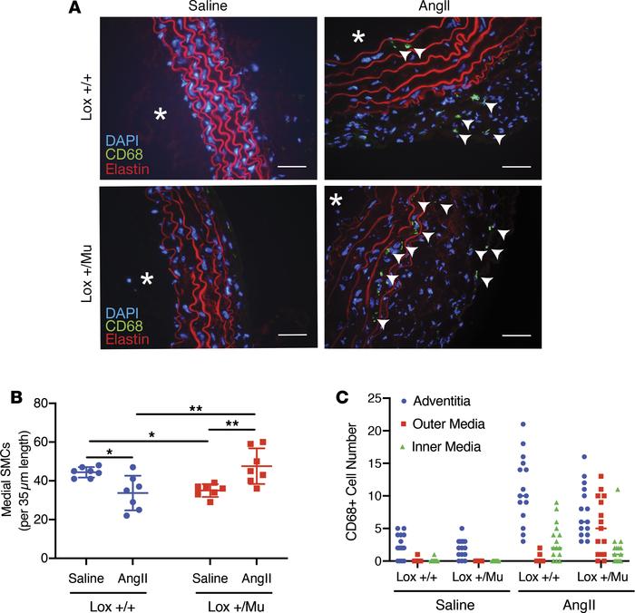 Ang II treatment leads to changes in vascular cellularity and infiltrati...