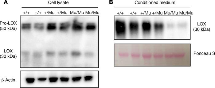 Mutant LOX is retained inside the cell.
(A) Immunoblotting of MEF lysate...