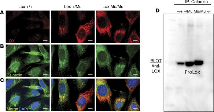 Intracellular mutant LOX interacts with ER-resident protein calnexin.
(A...