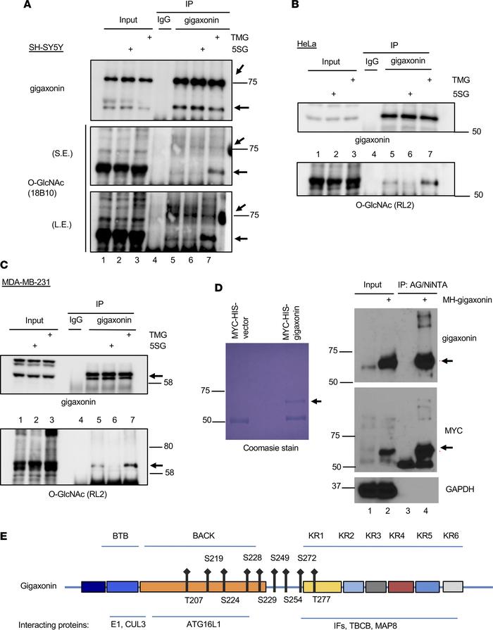 Site-specific O-GlcNAcylation of human gigaxonin.
(A–C) Inhibition of OG...