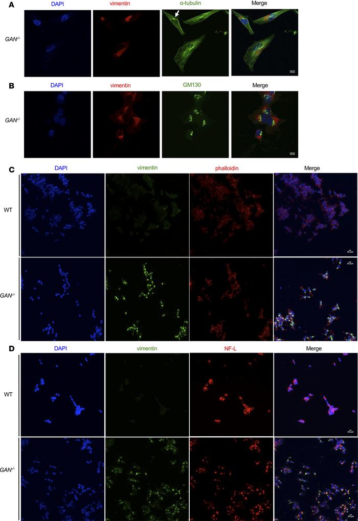 Distribution of vimentin aggregates, F-actin, and NF-L in CRISPR/Cas9-en...