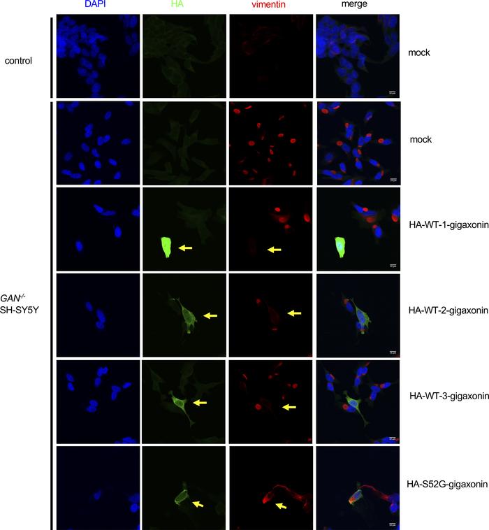 The vimentin aggregation phenotype is an appropriate assay for assessing...
