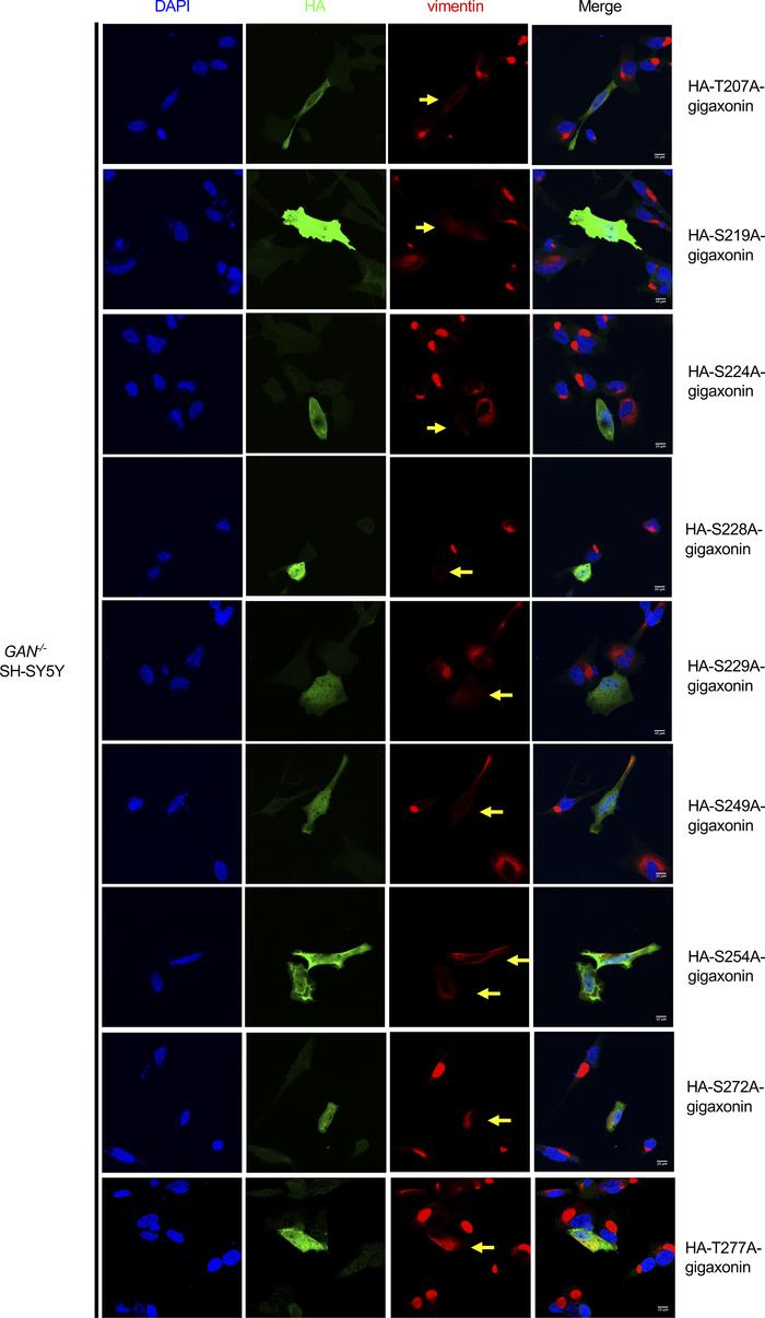S272A and T277A gigaxonin mutants exhibit the partial loss-of-function p...
