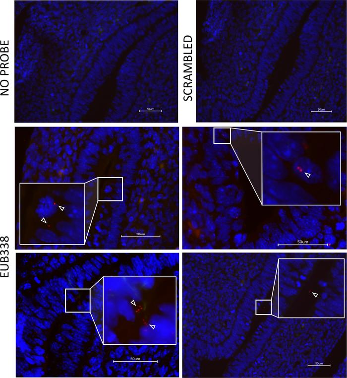 Identification of bacterial DNA in the murine fetal intestine by FISH of...