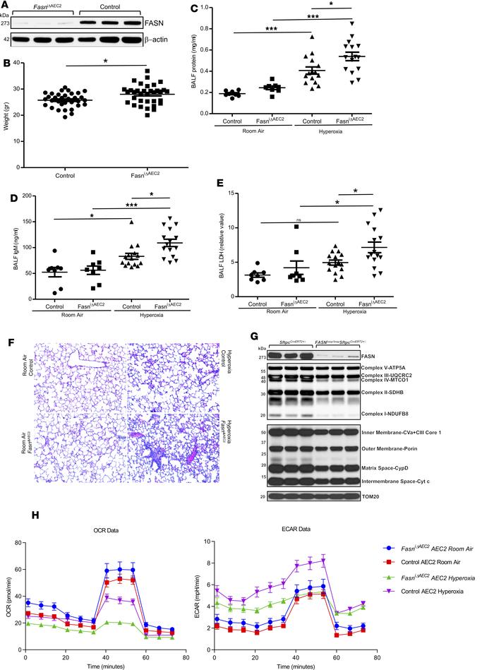 Mice deficient in FASN in alveolar epithelial cells are more susceptible...