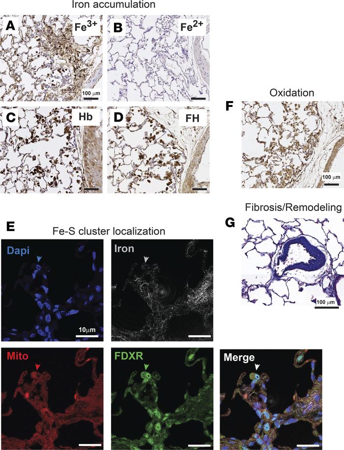 Characterization of iron that accumulates within rat Hb+Hx PH–associated...