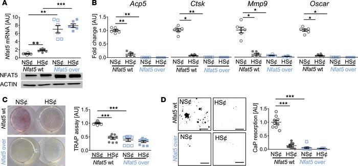 
Nfat5 overexpression prevented osteoclastogenesis of RANKL/M-CSF–treate...