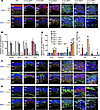 Rb1 KO and Vhl KO are synthetically lethal to retinal photoreceptors.