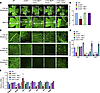 Hyperactive Rb1 inhibits the SVP in Ccnd1–/– retina.