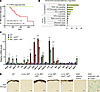 Vhl KO suppresses retinoblastoma formation in the Rb1/Rbl1–DKO retinas.