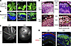 Rb1/Rbl1/Vhl TKO induces RCH-like and RAP-like lesions.