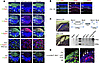 The cellular composition of the RCH-like and RAP-like lesions in the Rb1/Rb