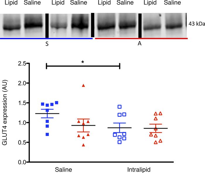 Expression of GLUT4 in skeletal muscle during saline or Intralipid infus...