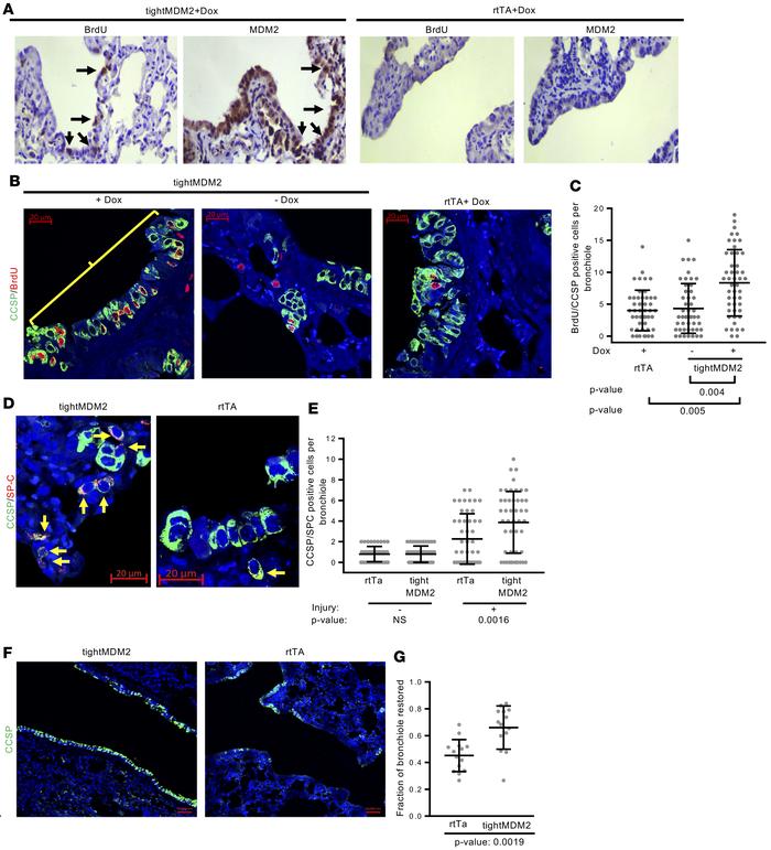 Dox-induced MDM2 expression in CCSP-expressing cells of mouse lung incre...