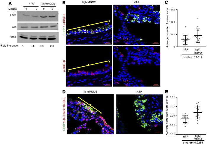 MDM2 activates the Akt signaling pathway consequent to naphthalene injur...