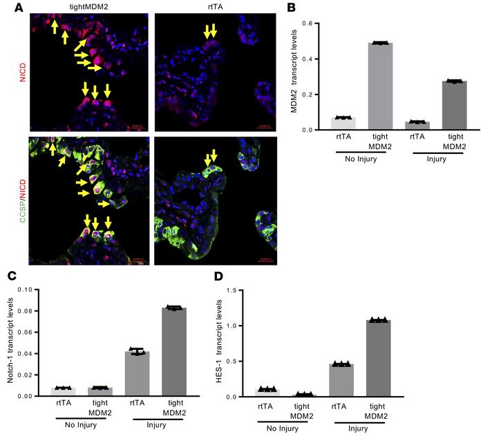 MDM2 activates the NOTCH signaling pathway consequent to naphthalene inj...