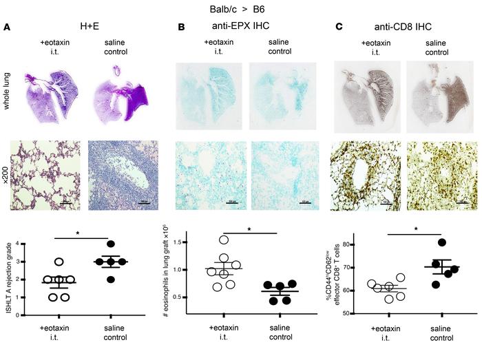 Rejection of BALB/c→B6 lung grafts treated with intratracheal eotaxin 1,...