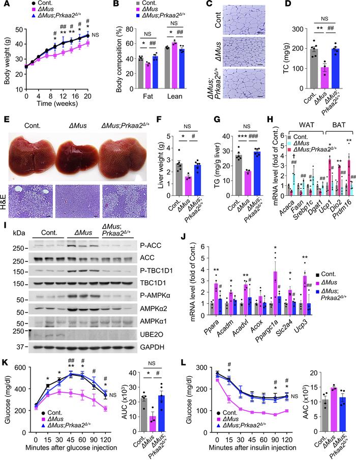 Activation of skeletal muscle AMPKα2 drives the protective effects of UB...