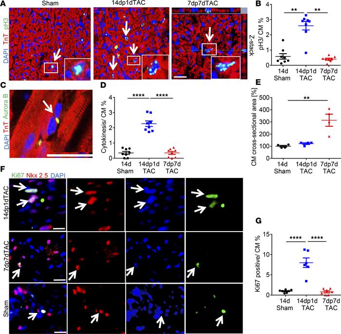 Pressure overload triggers cardiomyocyte proliferation in 1-day-old but ...