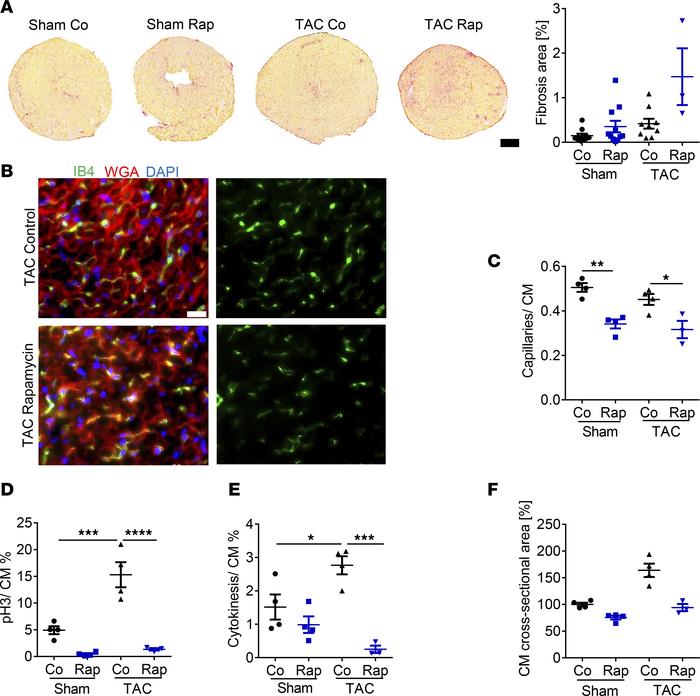 Increased fibrosis following pharmacological inhibition of cardiomyocyte...