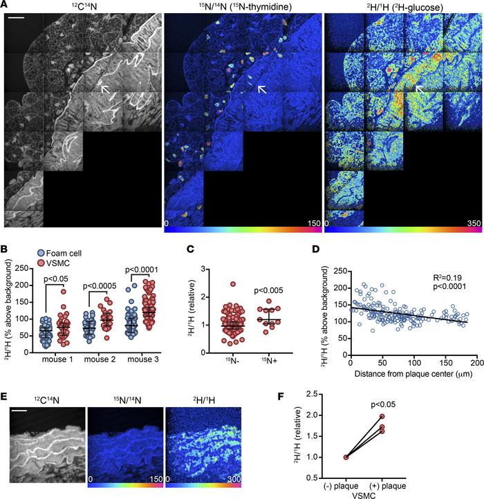 VSMCs underlying plaque are characterized by increased 2H-glucose labeli...