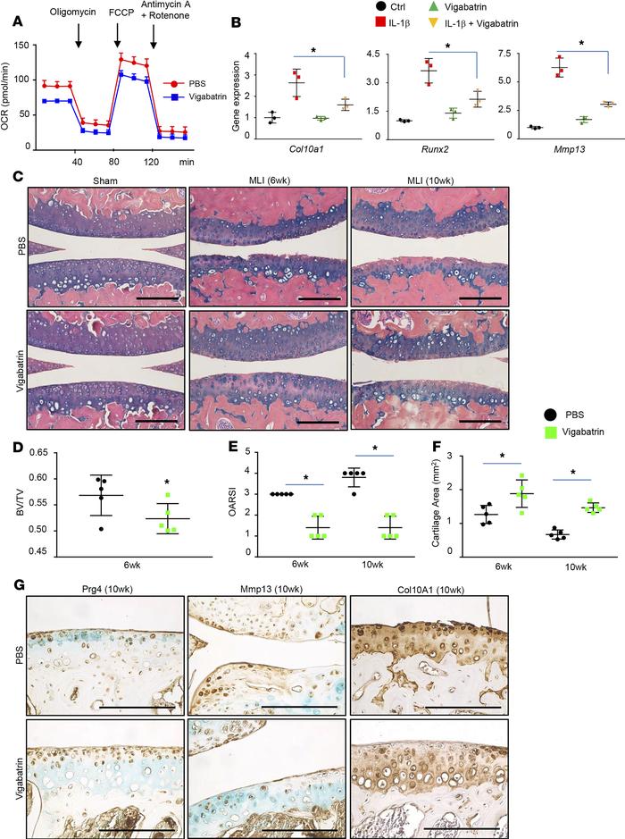 Vigabatrin attenuates chondrocyte hypertrophy and protects against injur...