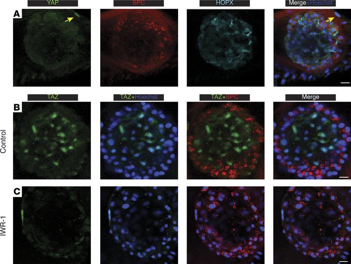 TAZ, but not YAP, is expressed (nuclear localized) during differentiatio...