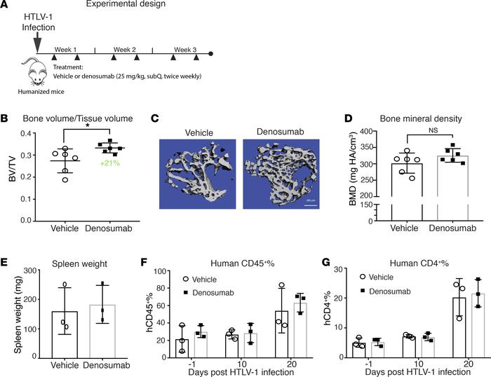 RANKL blockade with denosumab decreases disease-associated bone loss.
(A...