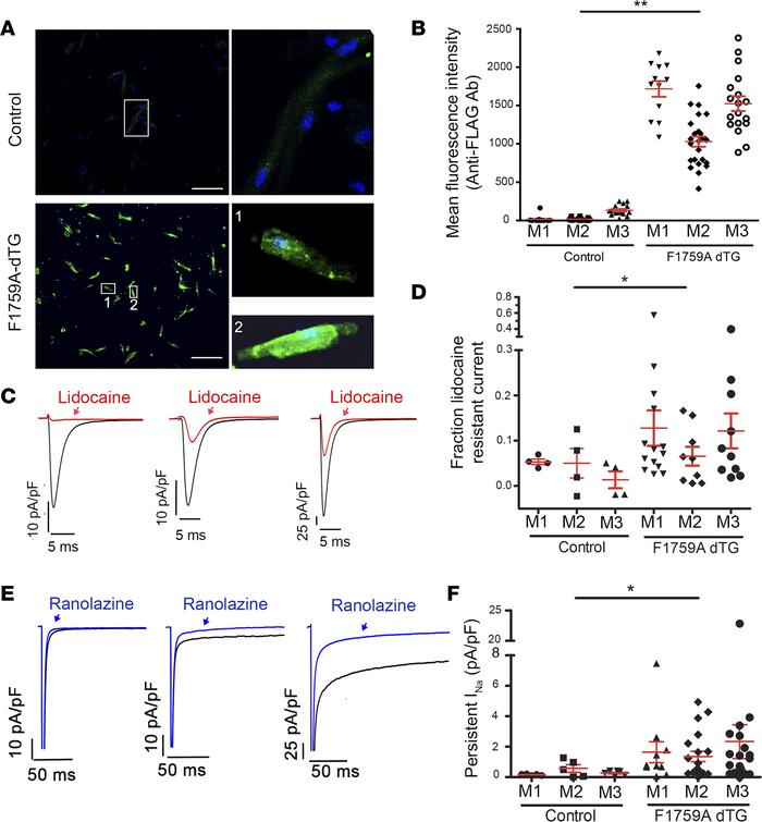 Inhomogeneity of TG NaV1.5 expression and persistent Na+ current in F175...