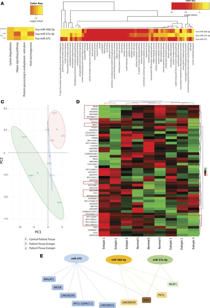 lncRNA-miRNA–seq analysis demonstrate intricate endometriosis-specific l...