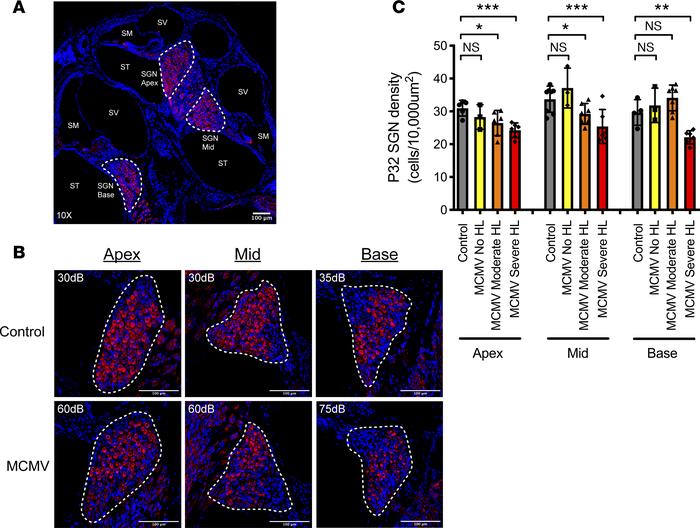 ABR elevation in MCMV-infected mice is associated with the level of SGN ...