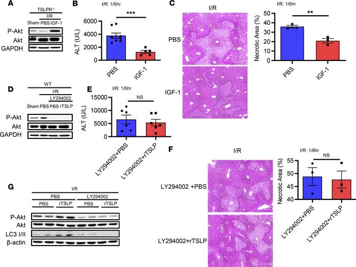 TSLP protects against liver I/R injury via PI3K/Akt pathway.
(A) Western...