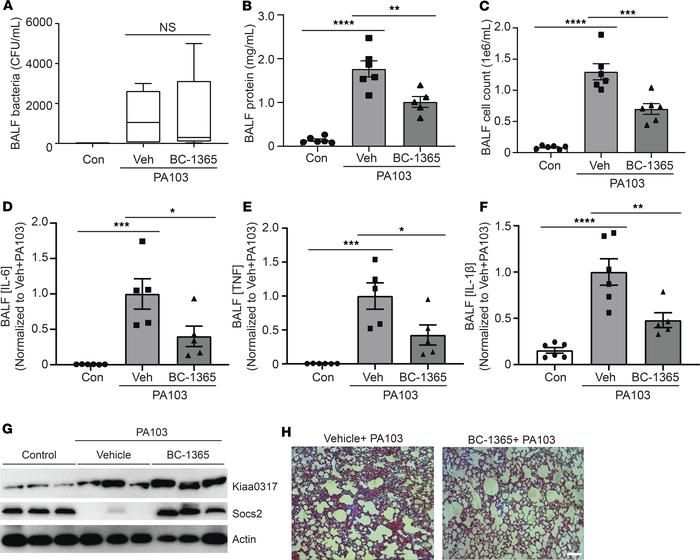 KIAA0317 small molecule inhibitor is antiinflammatory in vivo.
(A–E) C57...