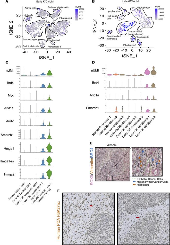 Analysis of transcriptional activity in different stages of PDA reveals ...