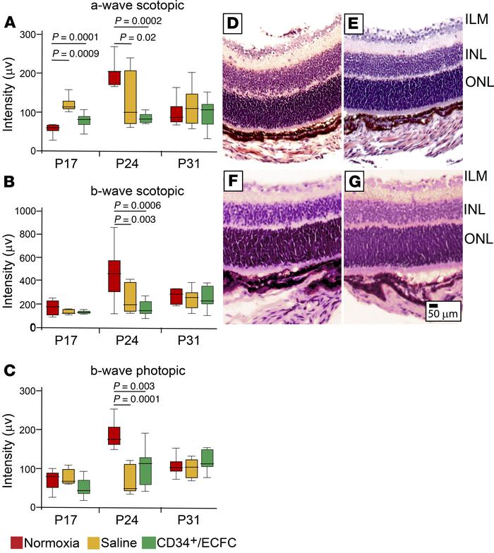 Combined treatment with CD34+ cells and ECFCs has no effect on neural re...