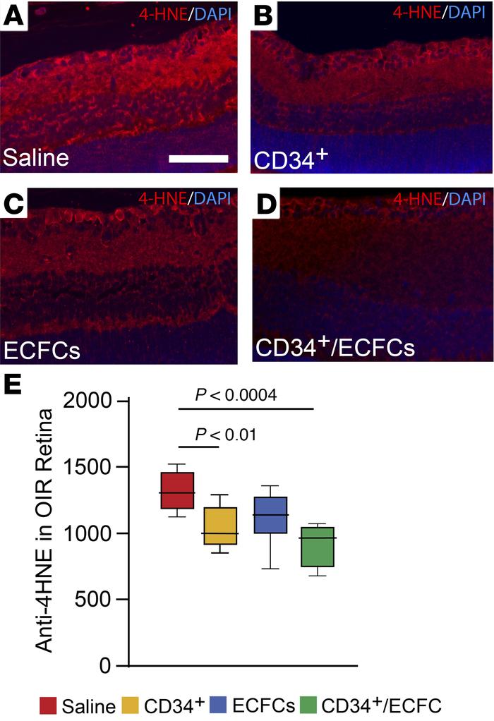 Combined treatment with CD34+ cells and ECFCs reduces oxidative stress.
...