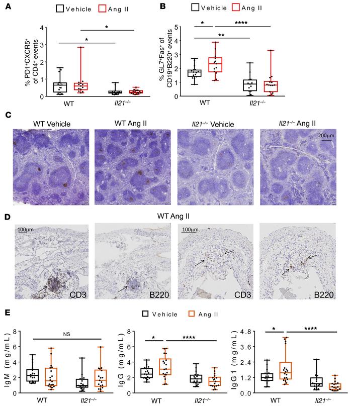 Hypertension induces an IL-21–dependent GC response, tertiary lymphoid d...
