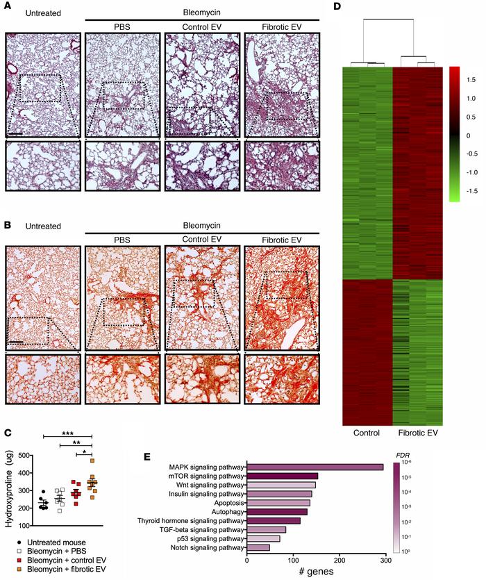 EVs within fibrotic lungs have profibrotic properties.
(A–C) WT mice wer...
