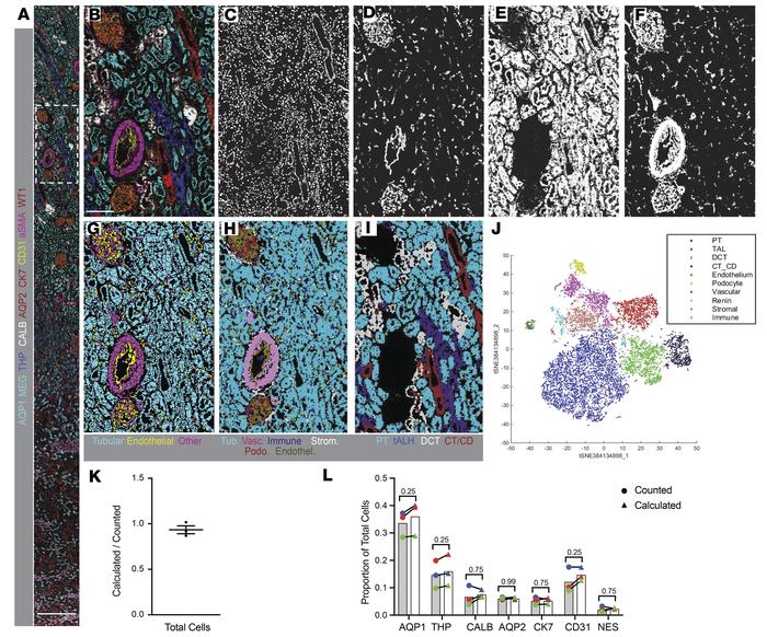 Single-cell segmentation, characterization, and quantification of a repr...