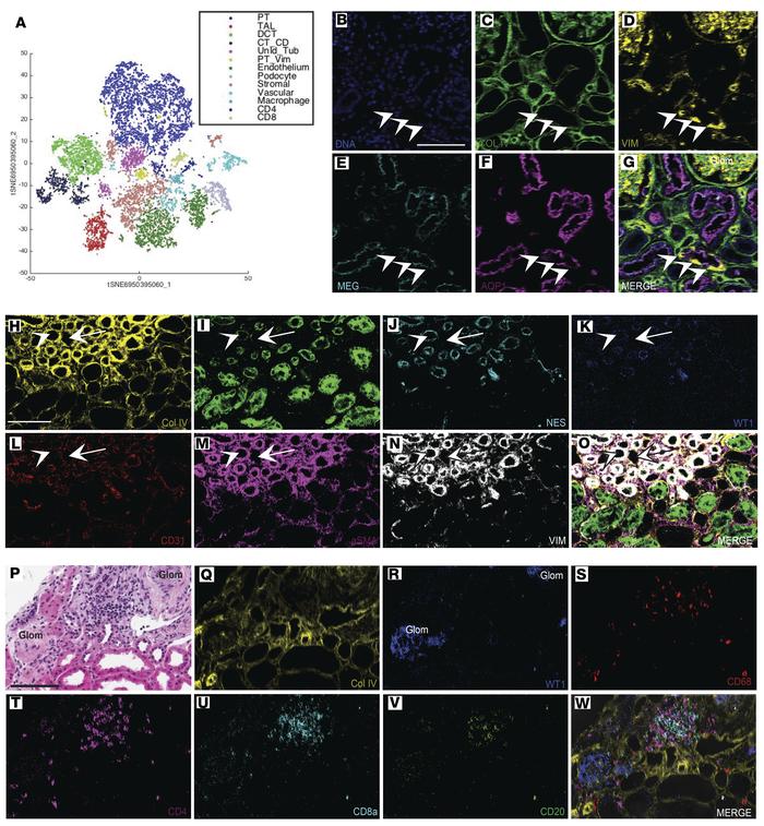 Kidney-MAPPS reveals potentially novel cell populations, unexpected mark...