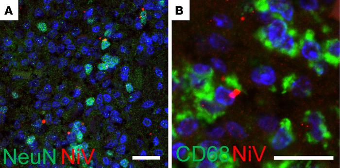 NiV persists mainly in brain neurons and microglia.
(A) NiV (red) is pre...