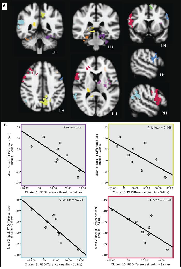 Brain areas showing significantly increased task-related fMRI activation...