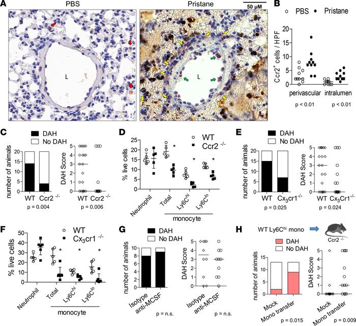 Attenuated DAH in mice deficient in monocyte chemoattractants.
(A) Immun...