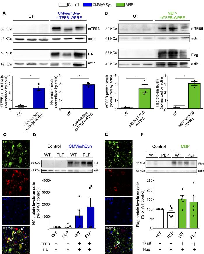 Sustainable TFEB transgene expression in vitro and in vivo.
(A) Represen...