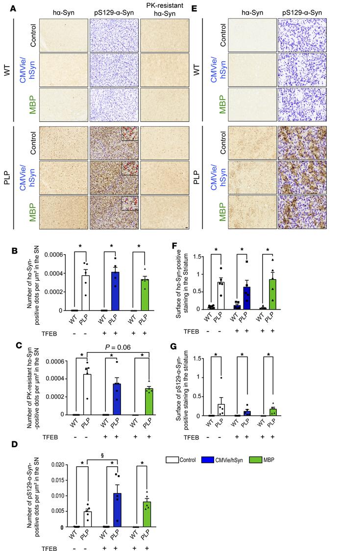 Oligodendroglial-targeted, but not neuronal TFEB–targeted, overexpressio...
