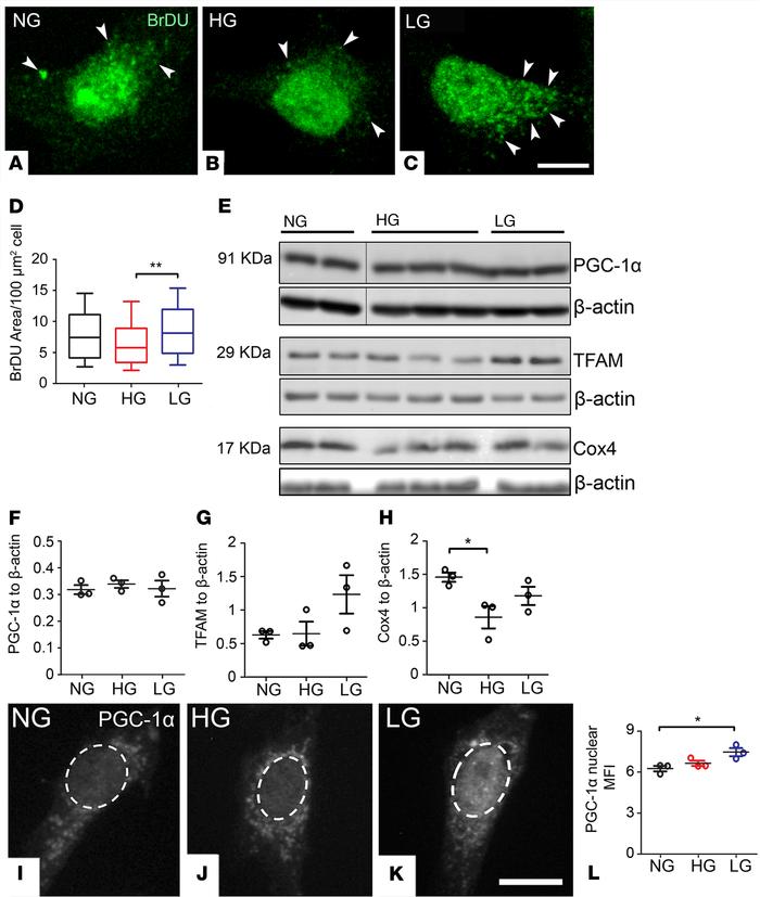 The diabetic milieu dysregulates mitochondrial biogenesis in MIO-M1 cult...