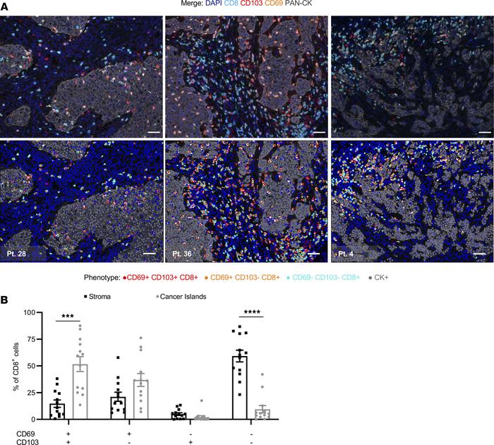 CD103 and CD69 expression by CD8+ TILs varies by localization within the...
