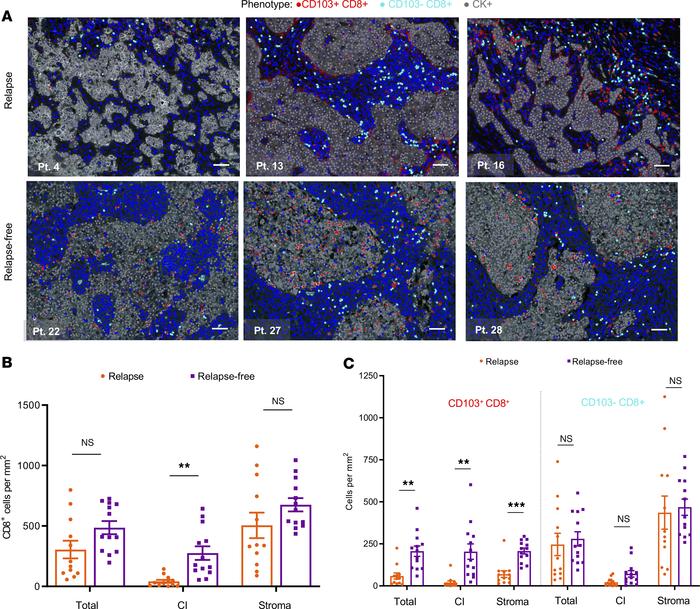 CD103+CD8+ TRM infiltration in breast tumors associates with relapse-fre...