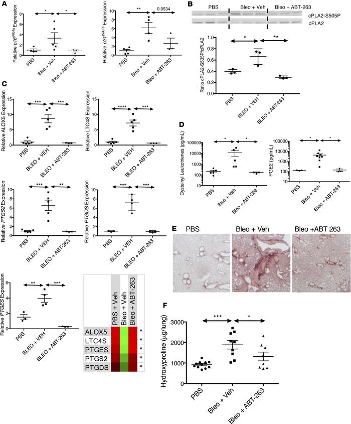 Senescence-associated leukotriene synthesis promotes pulmonary fibrosis....