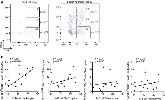 Potential Tph cells in lupus nephritis kidneys.
(A) Example of flow cyto...